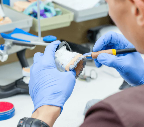 Prothèse fixe à Esch-sur-Alzette : comment New Dental Tech optimise le confort pour <span>ses</span> <span>patients</span> <span>?</span>